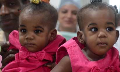 Nigerian conjoined twins “healthy” after operation in India