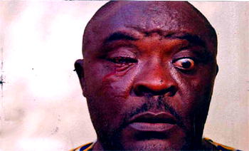 Naval officer injures Policeman’s eye with car key