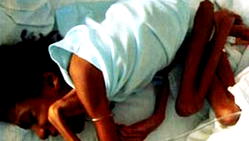 Centre, bank seek govt support for  Cerebral Palsy patients