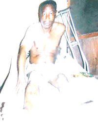 Policeman, 43, seeks N1.250m for corrective  leg surgery