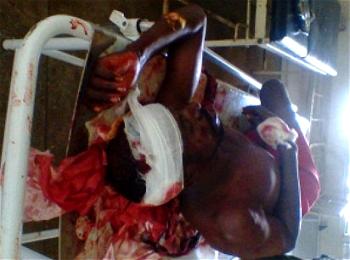 3 dead, scores injured in Kaduna clashes