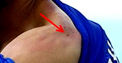 60-yr-old woman bites off neighbour’s ear