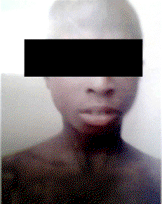 Witchcraft: Prophetess docked for setting boy ablaze