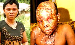 Married man ends up in jail after acid attack on lover