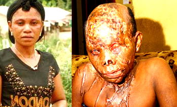 Married man ends up in jail after acid attack on lover