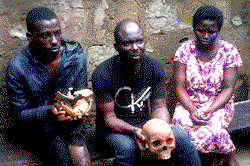 I was offered N30,000 for human skull —Suspect