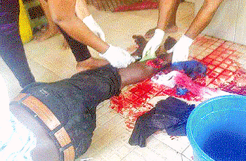 Life has been hell for me — Victim of alleged police brutality
