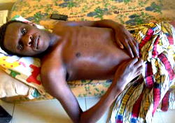 Mad cow paralyses man, 31, for 11 years 