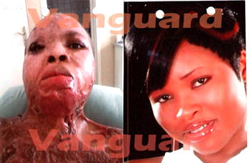 Ex-militant bathes former lover with acid