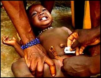 FGM: Any end to a needless practice?