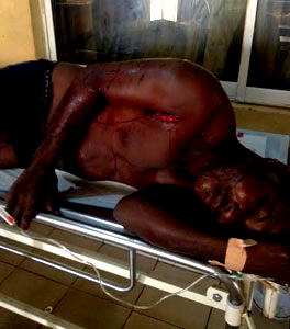 7 dogs attack driver in Lagos