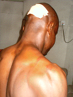 INEC official attacked by  thugs leaves hospital