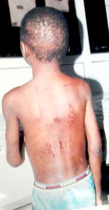 Residents rescue 2 siblings  from parents’ torture
