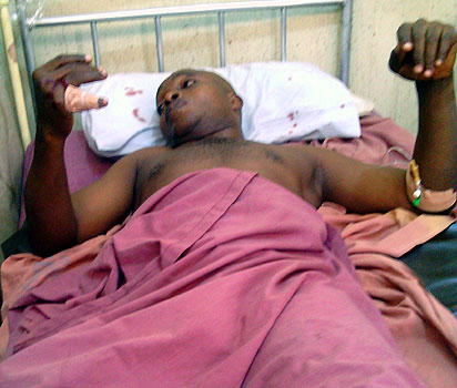 Robbers attack Vanguard staff, 13 pellets extracted