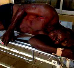 Man attacked by 7 dogs gets N30,000