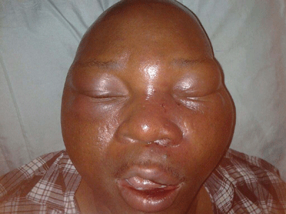 Hoodlums beat journalist to coma