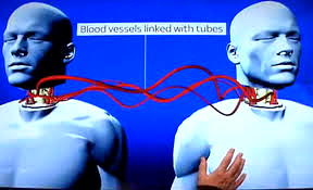 Surgeon promising first human head transplant makes US pitch