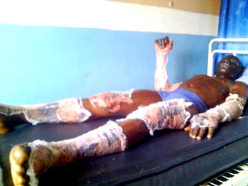 If only my father had listened to me —Survivor of Lagos gas explosion