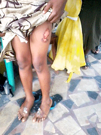 Man defiles 13-yr-old girl, wife lacerates her with hot knife, yam