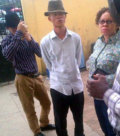 Albino Foundation demands explanation of member's death in Lagos ...