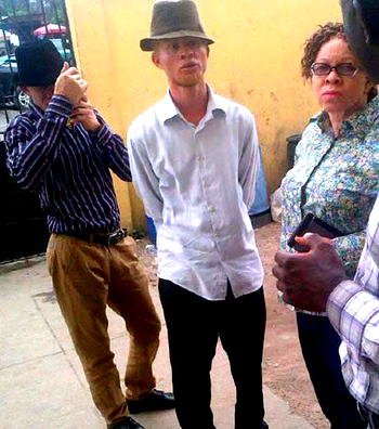 Albinos to get free eye glasses, sun protection cream in Ondo