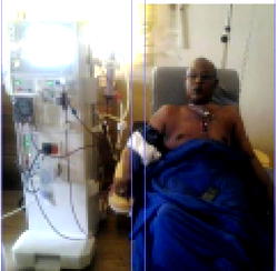 Kidney Failure: Olaoba, 49, seeks N7m lifesaver