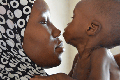 Malnutrition: Nigeria’s first in Africa, second worldwide