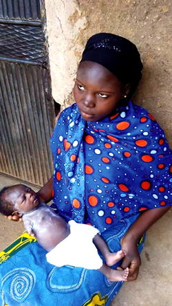 Baby without hands: ‘A blessing from God,’ says mother