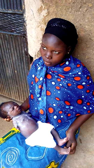 Baby without hands: ‘A blessing from God,’ says mother