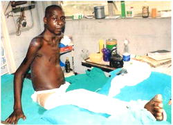 Mudiaga needs N2 million for knee surgery