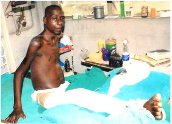 Mudiaga needs N2 million for knee surgery