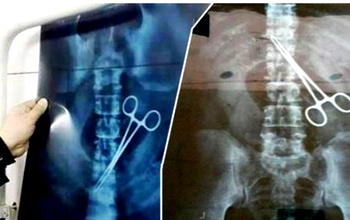 Shocking: How Saudi authorities found scissors in belly of Nigerian pilgrim