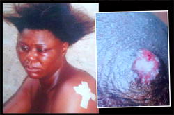 Woman arrested for biting off neighbour’s nipple