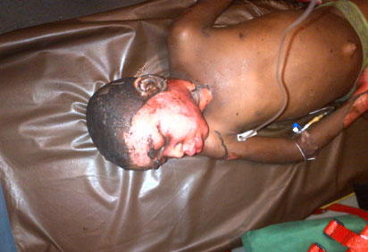 Lagos Fire: 8-year-old survivor dies in hospital
