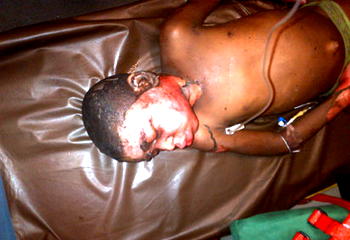 Lagos Fire: 8-year-old survivor dies in hospital