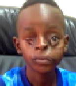 Boy, 6, seeks N3.5m to save his eyesight