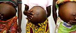 800,000 women caught in V VF nightmare