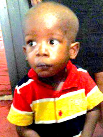 Help! 2-year-old boy born with hole-in-the-heart cries out