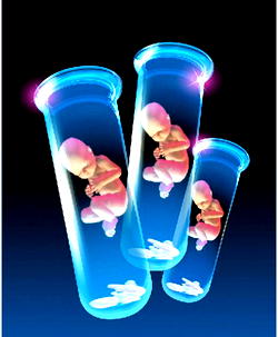 Cloning: Catholic medics raise alarm over human organs