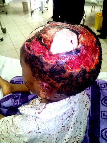 Beware of dogs!  Rabies on the prowl in Lagos
