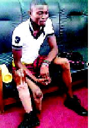 ABUJA BOMB BLAST VICTIM’S : ‘Five years after being scarred, I am still begging govt for attention!’