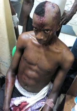 Policeman breaks students skull in Ogun