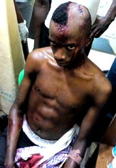 Policeman breaks students skull in Ogun