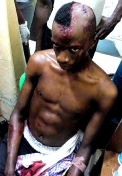 Policeman breaks students skull in Ogun