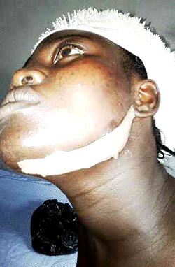 How I escaped being hacked to death — victim