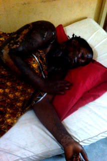 How lover boy killed girl friend in acid attack