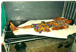 Lateefat seeks N0.9m to walk  again