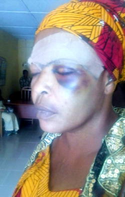 How landlady, children, nearly beat tenant to death in Lagos