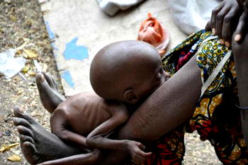 Communication: How Nigeria’s health inequalities can be tackled