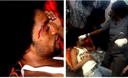 Video, Photos: Again! Denrele falls during movie shoot, injures self